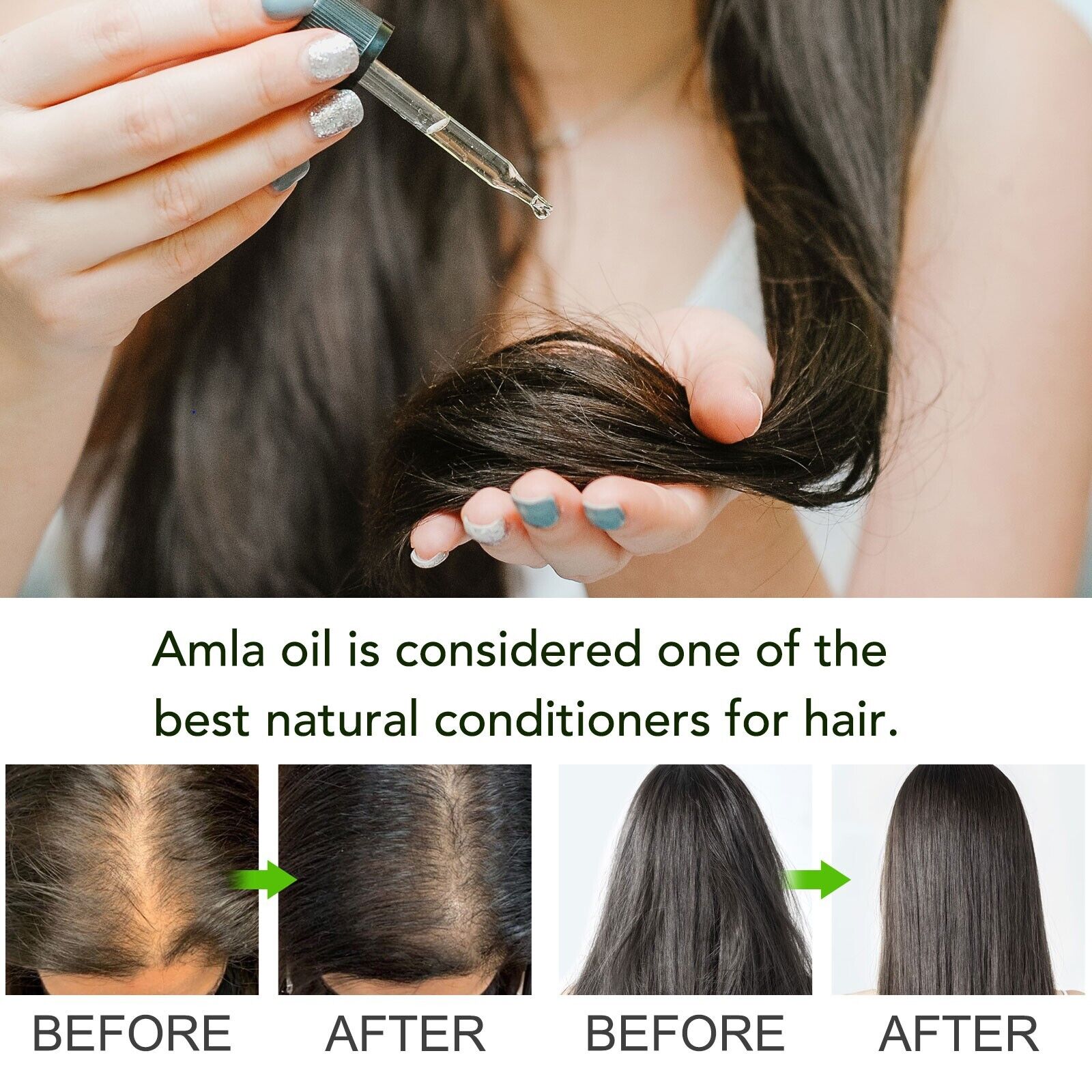 Amla Oil for Healthy Hair and Moisturized Scalp