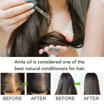 Amla Oil for Healthy Hair and Moisturized Scalp