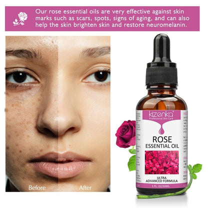 Rose Essential Oil, 100% Pure & Natural