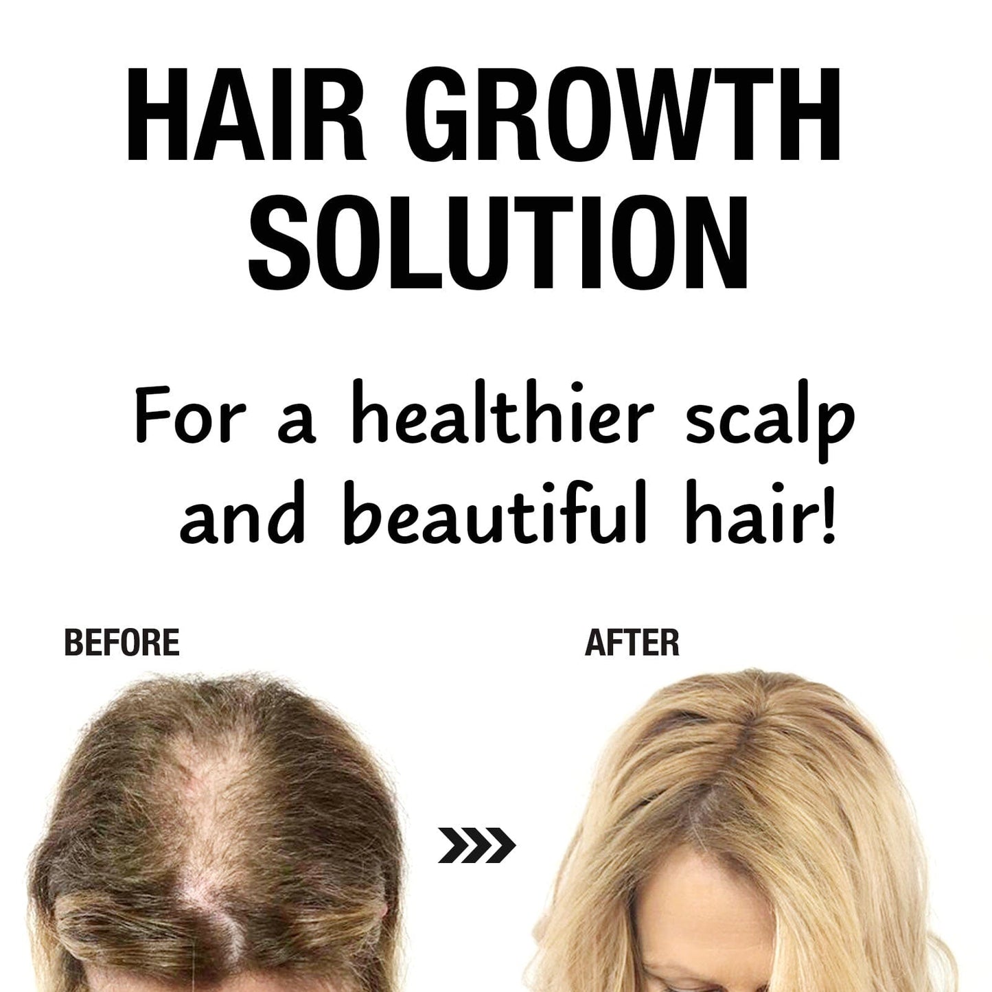 Hair Growth Power Oil